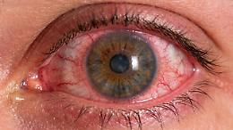 Virus dal mare agli occhi: scoperta choc su una nuova possibile infezione legata al pesce