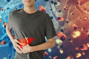 Cancro al fegato, il 60% dei casi si può prevenire: l’allarme della Commissione Lancet