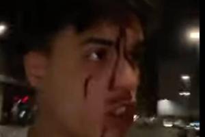 Don Alì picchiato a Milano: c’è chi dice sia solo una trovata spot