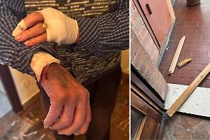 Ladro entra in casa e pesta un 86enne. Terrore a Barriera: «E' uno dei tossici del parco Sempione»