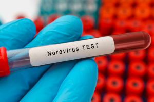 Norovirus, allerta sanitaria a Milano Cortina 2026