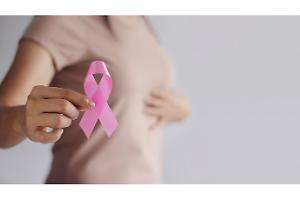 Tumore al seno: +1 milione di casi nel mondo entro il 2050 e fattori di rischio principali