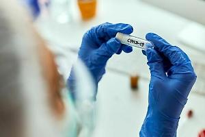 Cicada, la nuova variante Covid che sfugge alle difese: è già in tutto il mondo