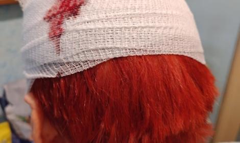 81enne cade mentre lucida una lapide, la figlia: "I vigilanti hanno sminuito ma poteva morire"