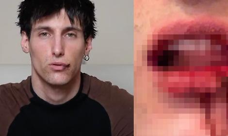 Il creator e modello Leo Mel aggredito sotto casa: un anno di minacce e violenze, &ldquo;Ma lui &egrave; ancora libero&rdquo;