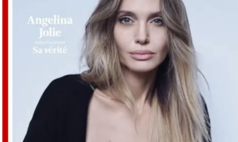 La &ldquo;sindrome di Angiolina Jolie&rdquo;, una malformazione pi&ugrave; comune di quel che si pensa