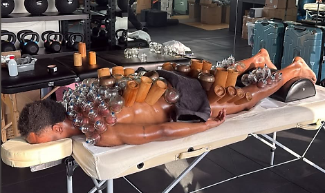 Openda e la "coppettazione": ecco chi la fa e a cosa serve