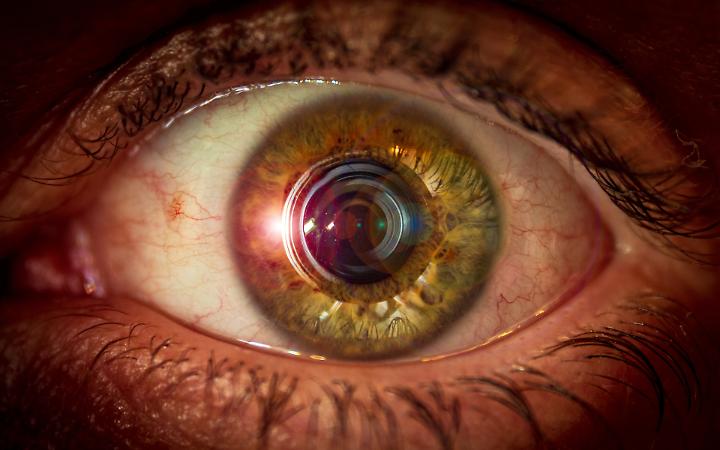 Le donne non possono essere daltoniche (o quasi): ecco perché è un disturbo maschile