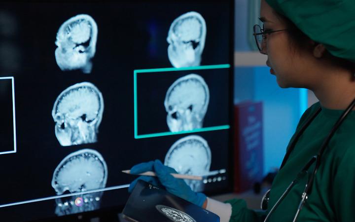 Malattie rare, da Torino una scoperta che apre nuove strade per le terapie